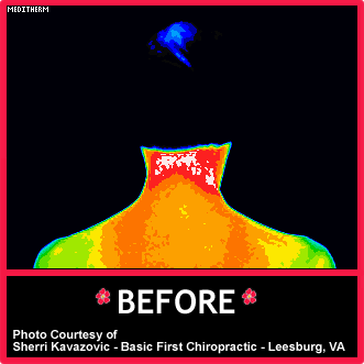 Digital Thermal Imaging Before 2