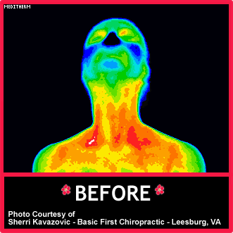 Digital Thermal Imaging Before 1